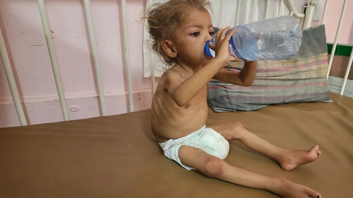 Gazze’de çocuklar açlıktan ölürken obez çocuk sayısı ilk kez “düşük kilolu çocuk sayısını geçti”